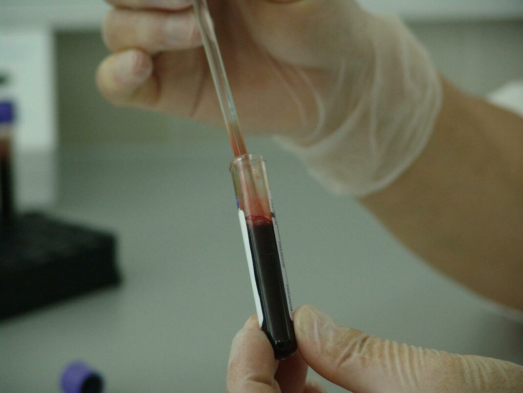 blood count looking for anemia, cancer markers